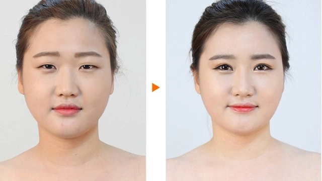 Sở hữu nhan sắc mềm mại khó tin những mỹ nhân làng giải trí này từng trải qua dao kéo - 11
