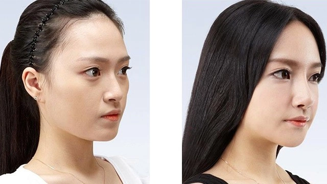 Sở hữu nhan sắc mềm mại khó tin những mỹ nhân làng giải trí này từng trải qua dao kéo - 12