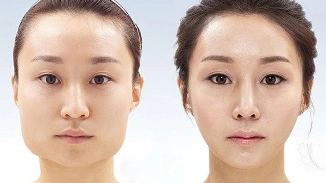 Sở hữu nhan sắc mềm mại khó tin những mỹ nhân làng giải trí này từng trải qua dao kéo - 13