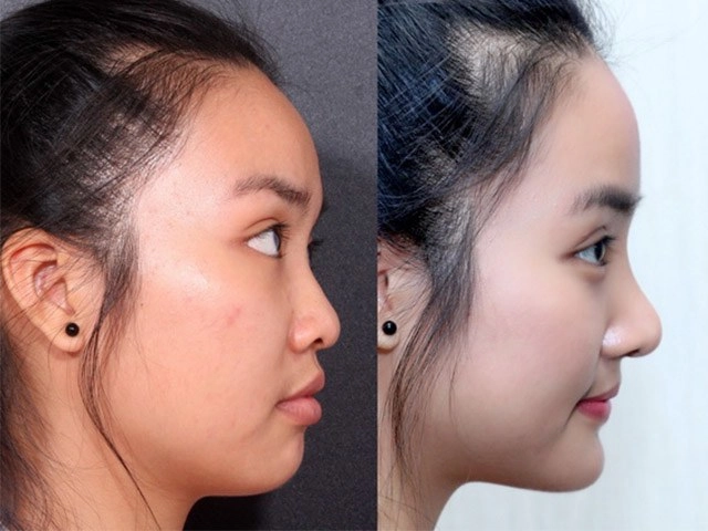 Sở hữu nhan sắc mềm mại khó tin những mỹ nhân làng giải trí này từng trải qua dao kéo - 14