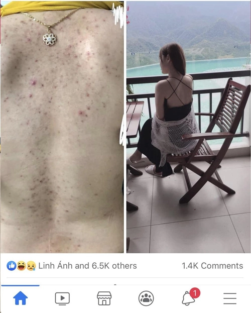 Sữa tắm đánh bay mụn lưng thế hệ thứ 2 của some by mi liệu có còn thần thánh - 5