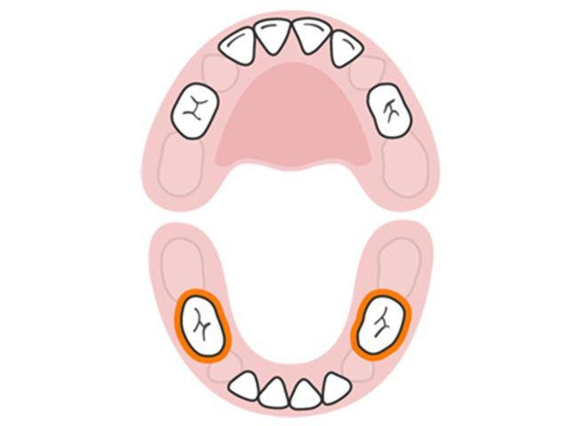 Thứ tự mọc răng của bé từ sơ sinh đến 3 tuổi cha mẹ cần quan tâm - 8