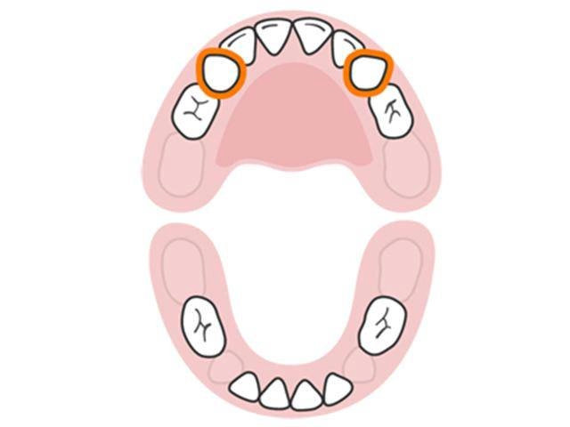 Thứ tự mọc răng của bé từ sơ sinh đến 3 tuổi cha mẹ cần quan tâm - 9