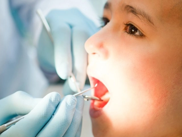 Thứ tự mọc răng của bé từ sơ sinh đến 3 tuổi cha mẹ cần quan tâm - 13