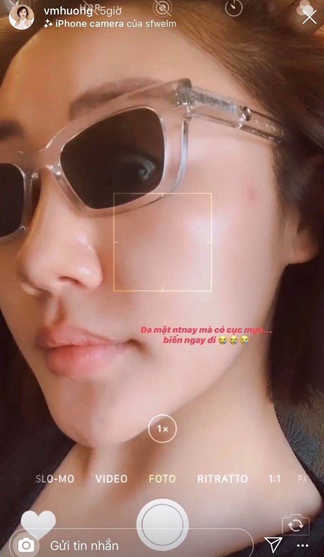 Văn mai hương than khóc vì mụn dân tình chỉ chú ý đến mặt mộc căng bóng không tì vết - 1