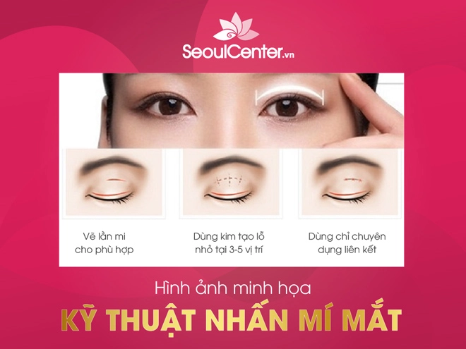 5 điểm khác biệt khi nhấn mí hàn quốc tại seoul center - 2
