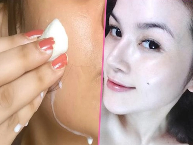 7 loại mặt nạ trị nám đắp đến đâu da tự khắc trắng hồng đến đó hết sạch thâm sạm - 9
