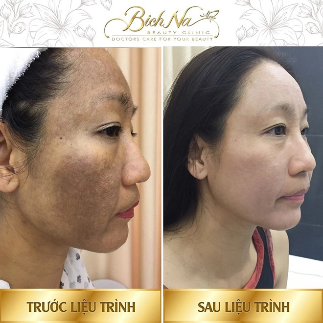 Bichna beauty và hành trình 5 năm tâm huyết giúp phụ nữ việt đẹp hơn mỗi ngày - 4
