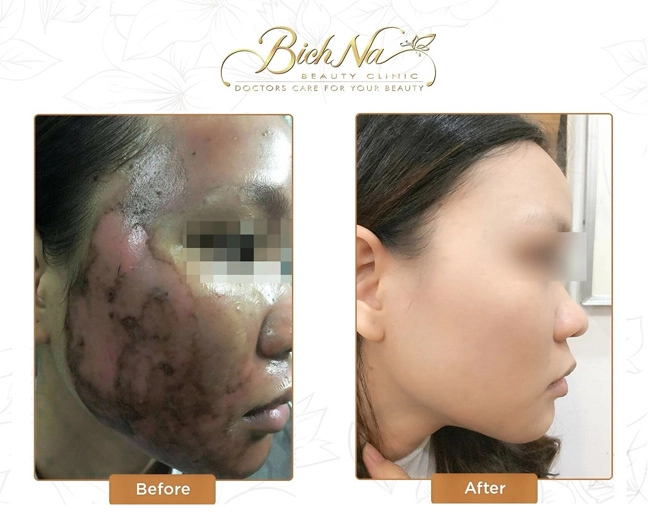 Bichna beauty và hành trình 5 năm tâm huyết giúp phụ nữ việt đẹp hơn mỗi ngày - 5