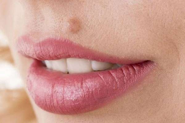 Cách trị mụn bọc sưng đỏ mủ ở mũi cằm tại nhà an toàn hiệu quả - 3