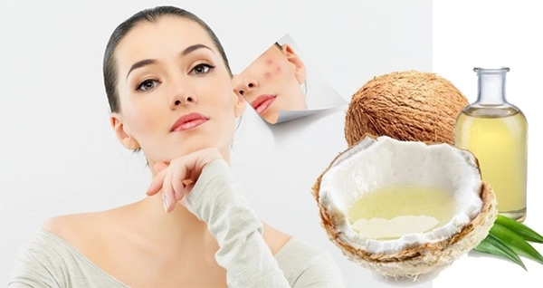 Cách trị mụn thâm tại nhà hiệu quả nhanh nhất từ tự nhiên - 1