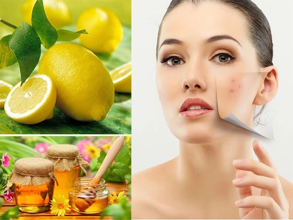 Cách trị mụn thâm tại nhà hiệu quả nhanh nhất từ tự nhiên - 5