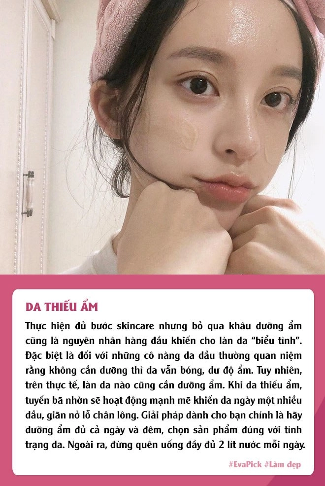 Càng dưỡng da càng đổ dầu lỗ chân lông nở to phải chăng bước skincare của bạn có vấn đề - 3