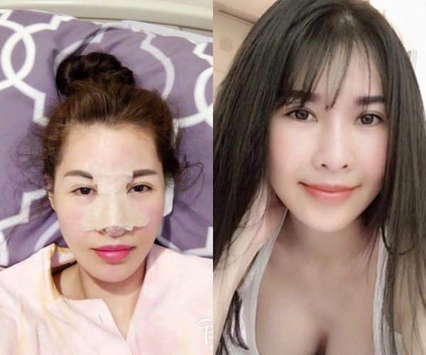 Để giữ được vẻ đẹp đôi mươi cô bạn từng thân của hà hồ phải chi tiền tỷ dao kéo - 3