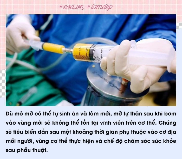 Để không gặp biến chứng nàng lưu ngay các sai lầm phổ biến thường gặp khi cấy mỡ tự thân - 5