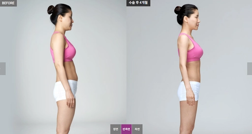 Gái hàn ăn thả ga rồi đi hút mỡ chị em cập nhật nhanh 5 công nghệ hàng đầu này - 1