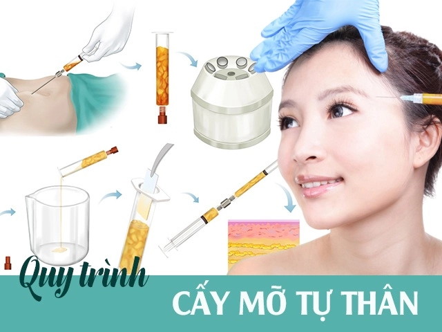 Gái hàn ăn thả ga rồi đi hút mỡ chị em cập nhật nhanh 5 công nghệ hàng đầu này - 6