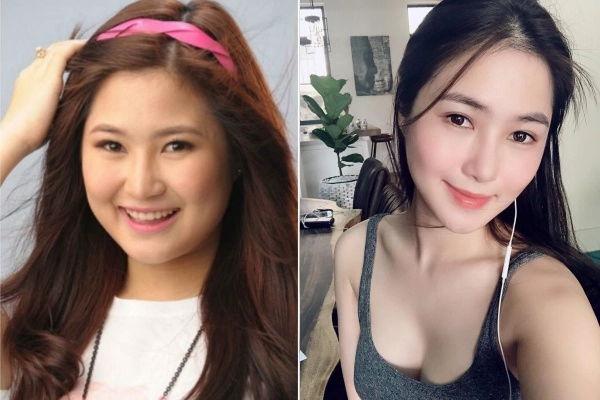 Hương tràm đẹp lên bội phần nhờ chiếc mũi thanh tú sau phẫu thuật thẩm mỹ - 1