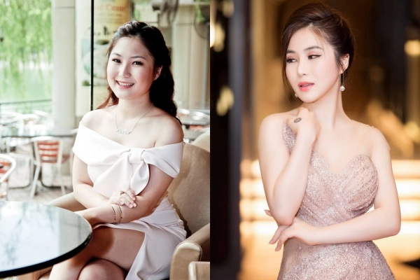 Hương tràm đẹp lên bội phần nhờ chiếc mũi thanh tú sau phẫu thuật thẩm mỹ - 2