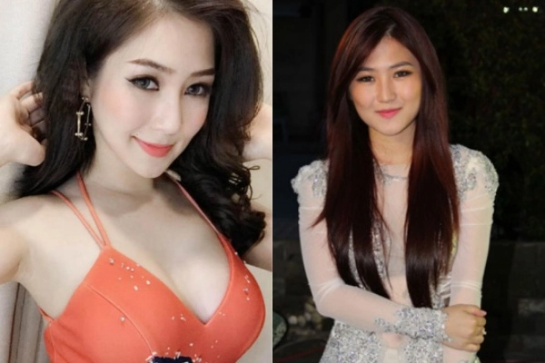 Hương tràm đẹp lên bội phần nhờ chiếc mũi thanh tú sau phẫu thuật thẩm mỹ - 3