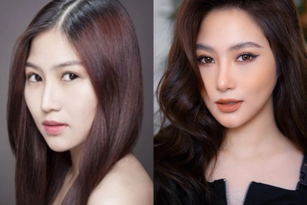 Hương tràm đẹp lên bội phần nhờ chiếc mũi thanh tú sau phẫu thuật thẩm mỹ - 5