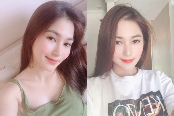 Hương tràm đẹp lên bội phần nhờ chiếc mũi thanh tú sau phẫu thuật thẩm mỹ - 6