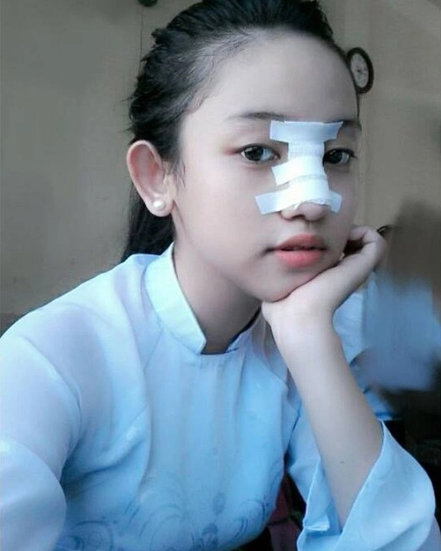 Loạt sao châu á bị nghi phẫu thuật thẩm mỹ vì nhan sắc biến dạng mũi lệch mặt méo xệch - 10