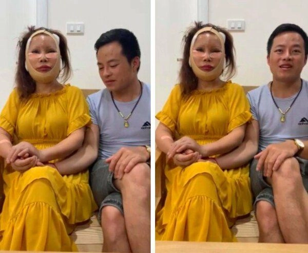 Mới căng da mặt xong cô dâu cao bằng lại muốn trùng tu vòng 1 liệu có quá vội vàng - 1