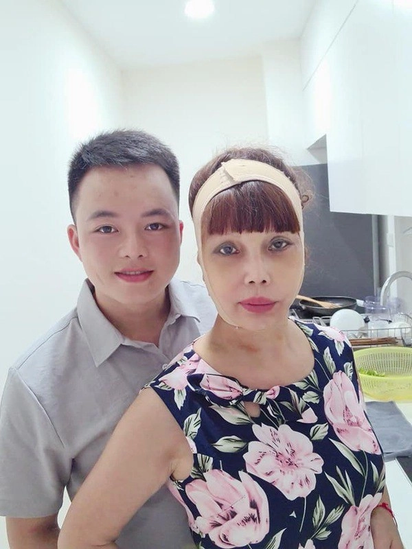 Mới căng da mặt xong cô dâu cao bằng lại muốn trùng tu vòng 1 liệu có quá vội vàng - 3