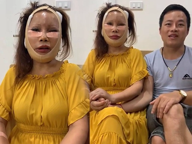 Khoe ảnh đẹp tưởng được khen cô dâu 62 tuổi bị soi nhan sắc sau 1 tháng phẫu thuật - 9