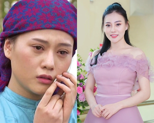 Quỳnh búp bê và cú lột xác ngoạn mục nhờ chỉnh lại chiếc mũi - 1
