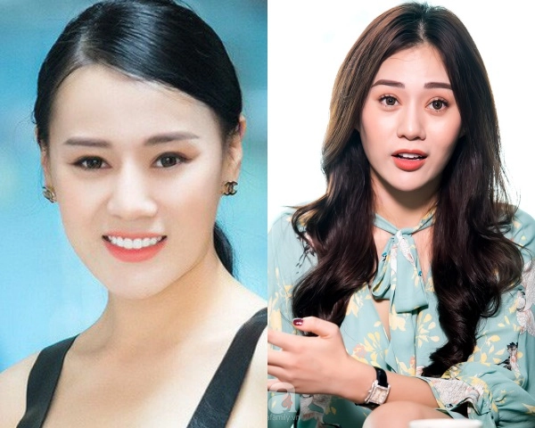 Quỳnh búp bê và cú lột xác ngoạn mục nhờ chỉnh lại chiếc mũi - 2