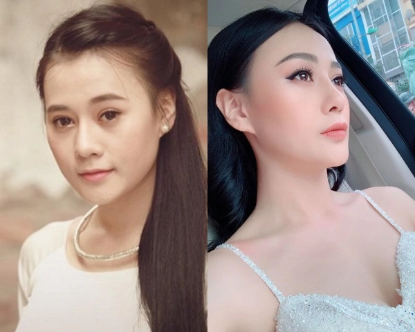 Quỳnh búp bê và cú lột xác ngoạn mục nhờ chỉnh lại chiếc mũi - 3