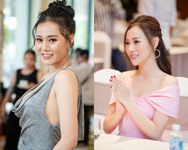 Quỳnh búp bê và cú lột xác ngoạn mục nhờ chỉnh lại chiếc mũi - 5