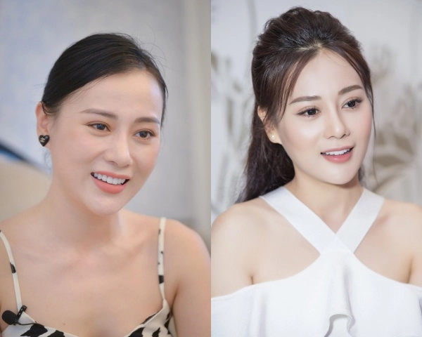 Quỳnh búp bê và cú lột xác ngoạn mục nhờ chỉnh lại chiếc mũi - 6
