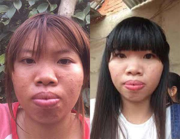 Sau nhiều năm dao kéo phượng thị nở đăng đàn chuyện bị chế giễu bởi quá khứ kém xinh - 1