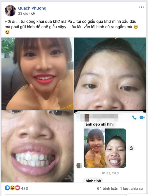 Sau nhiều năm dao kéo phượng thị nở đăng đàn chuyện bị chế giễu bởi quá khứ kém xinh - 6