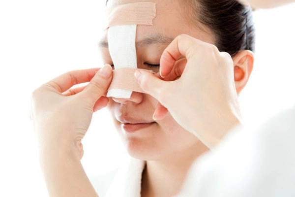 Sau nhiều năm dao kéo phượng thị nở đăng đàn chuyện bị chế giễu bởi quá khứ kém xinh - 9