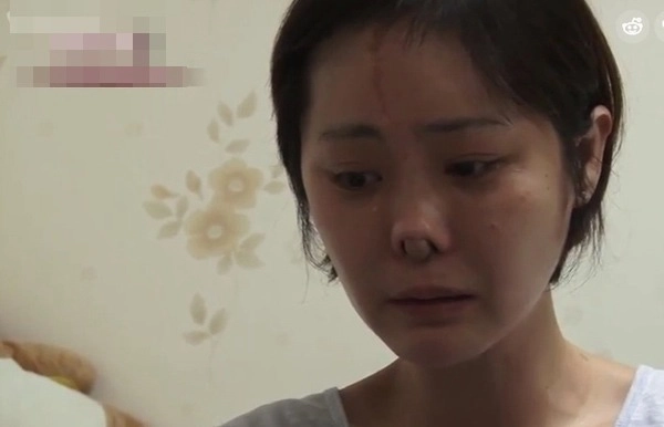 Sau nhiều năm dao kéo phượng thị nở đăng đàn chuyện bị chế giễu bởi quá khứ kém xinh - 11