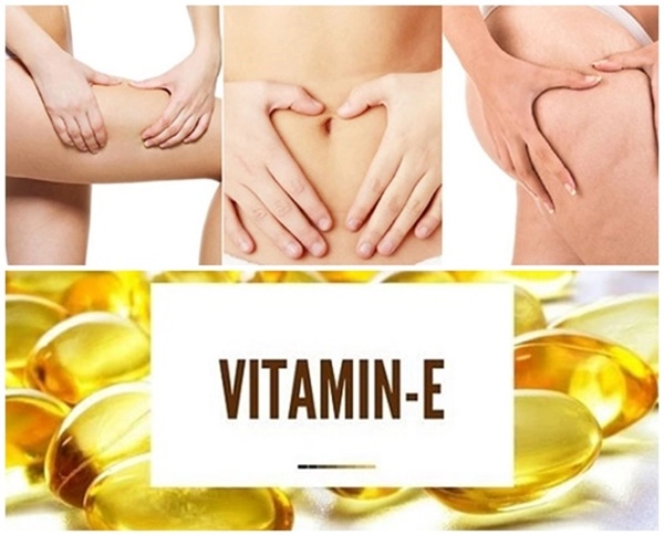 Trị rạn da sau sinh lâu năm hiệu quả nhanh nhất hiện nay - 4