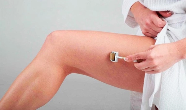 Trị rạn da sau sinh lâu năm hiệu quả nhanh nhất hiện nay - 8