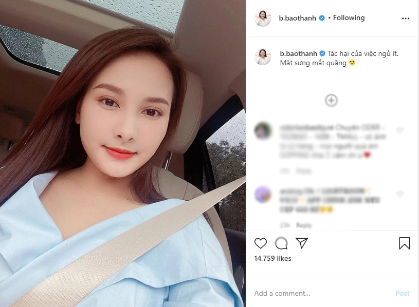 Tưởng bảo thanh tiêm filler nên mặt sưng hoá ra là do thói quen xấu nàng hay mắc - 7