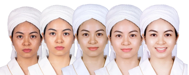 Viên uống đẹp da gluta tone white rose được phụ nữ việt săn đón - 3