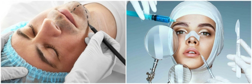 Xuất hiện nghệ sĩ nam phẫu thuật thẩm mỹ còn nhiều hơn cả chị em vbiz - 10