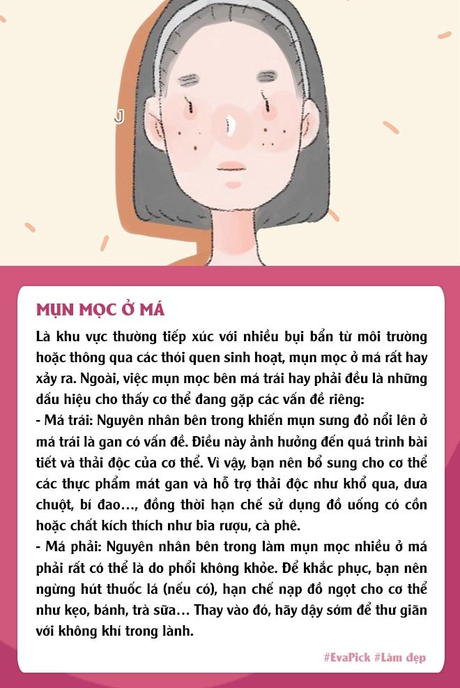 6 vị trí mụn mọc thường gặp trên gương mặt nói gì về tình trạng cơ thể bạn - 5