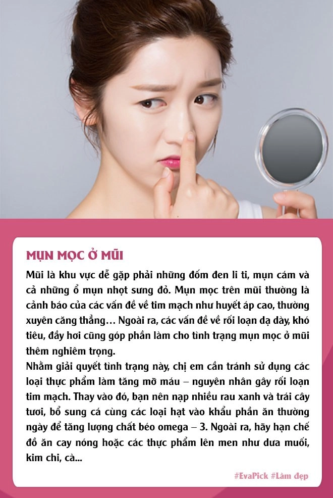 6 vị trí mụn mọc thường gặp trên gương mặt nói gì về tình trạng cơ thể bạn - 6