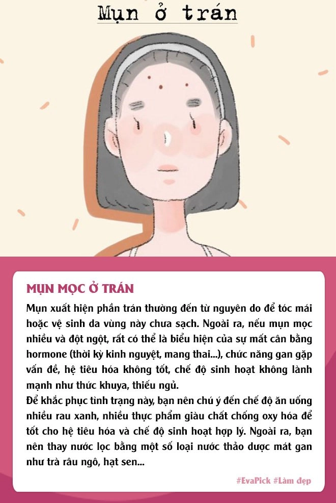 6 vị trí mụn mọc thường gặp trên gương mặt nói gì về tình trạng cơ thể bạn - 1