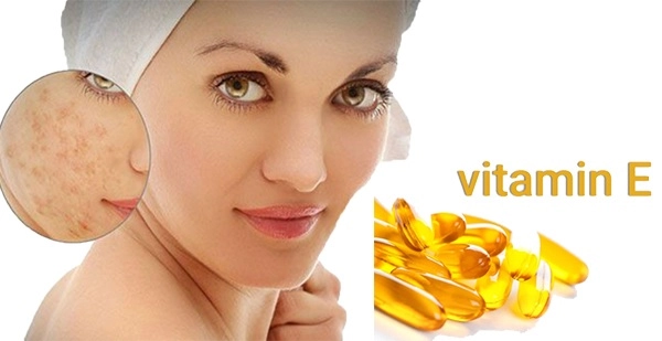 Cách trị sẹo rỗ trên mặt lâu năm tại nhà hiệu quả nhanh nhất - 4