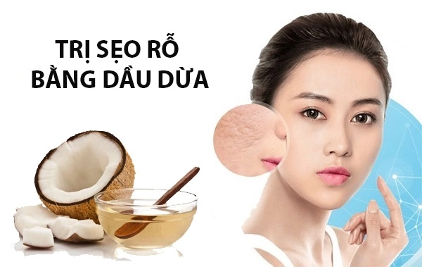 Cách trị sẹo rỗ trên mặt lâu năm tại nhà hiệu quả nhanh nhất - 7