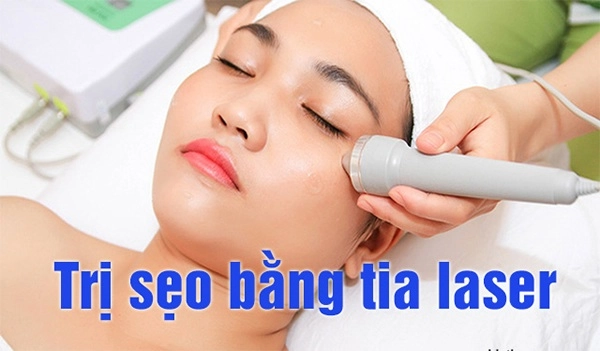 Cách trị sẹo rỗ trên mặt lâu năm tại nhà hiệu quả nhanh nhất - 11